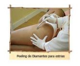 peeling de diamante para estrias